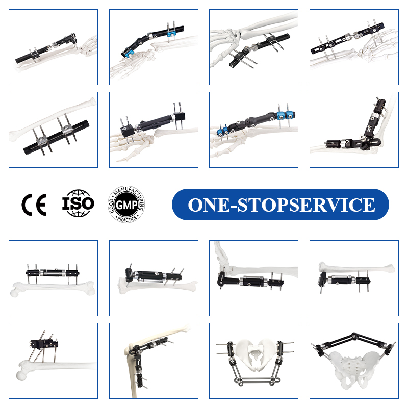 Customized OEM for orthopedic external fixation devices
