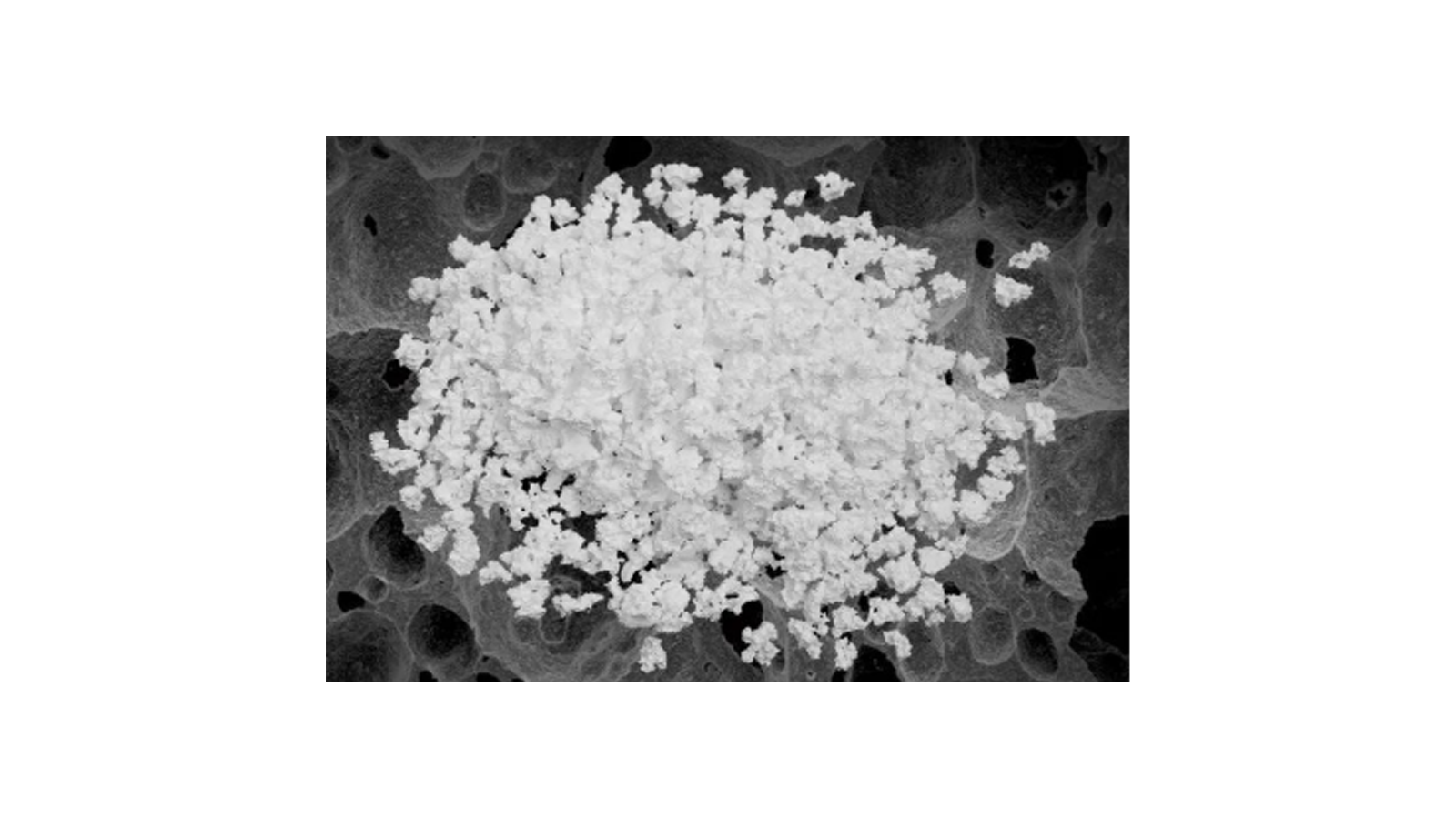 Biological Ceramic Artificial Bone — BC.Gr.0001 — d(mm): 0.2～1.0 w(g): 0.25