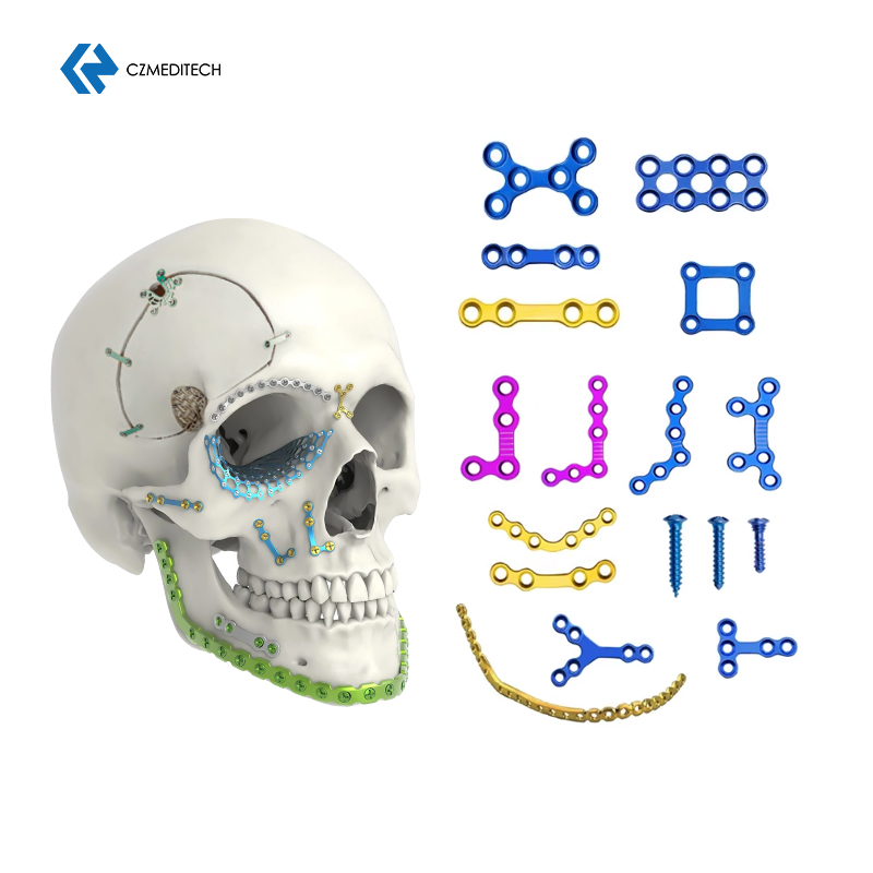 CMF implant-CZMEDITECH.jpg