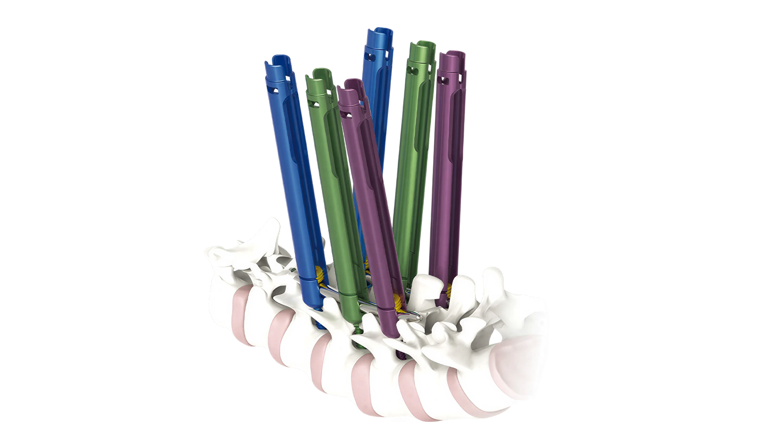 MINTRA™ 5.5 MIS Thoracolumbar Fixation System