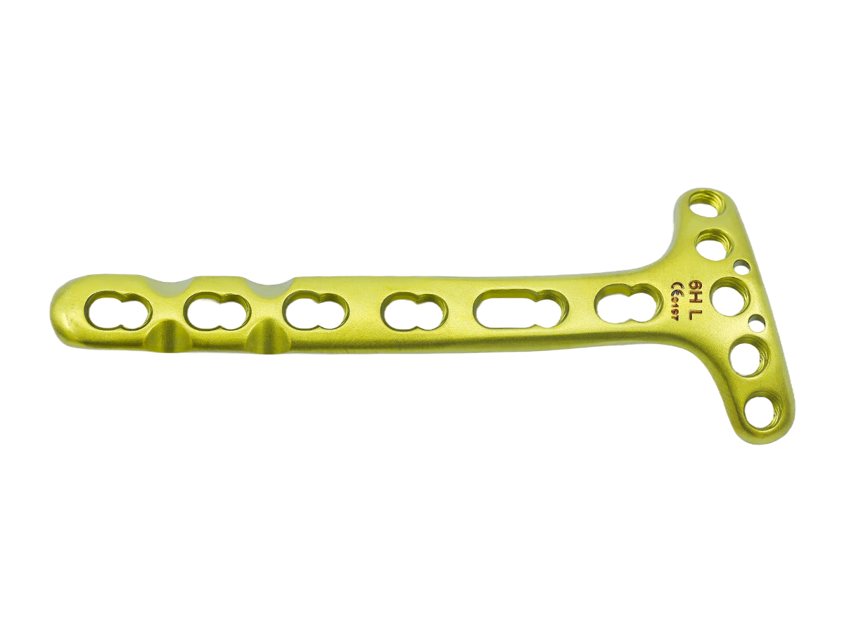 Distal Dorsal Radial Delta Locking Plate - Design II CZMEDITECH