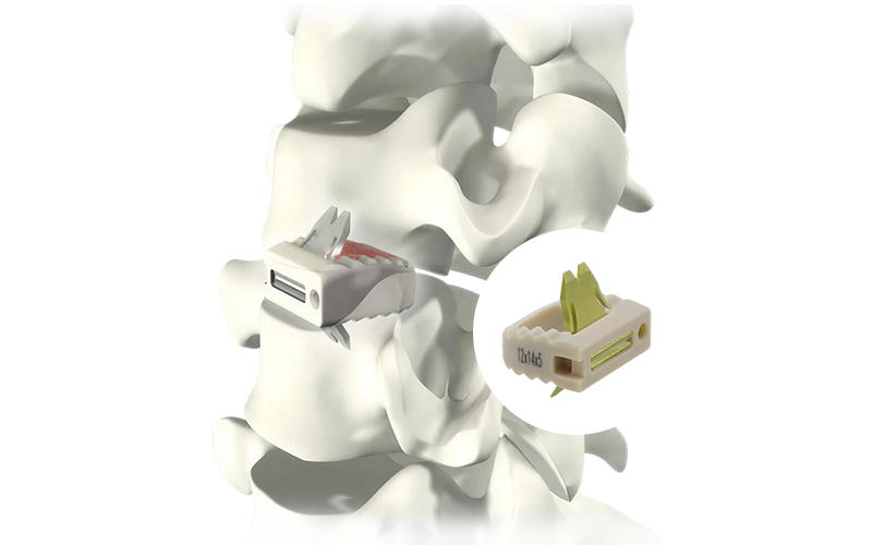 Uni-C-Standalone-Cervical-Cage