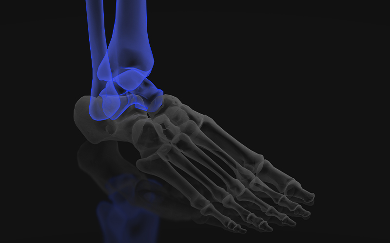 Ankle region highlighted in blue on a skeletal anatomy illustration