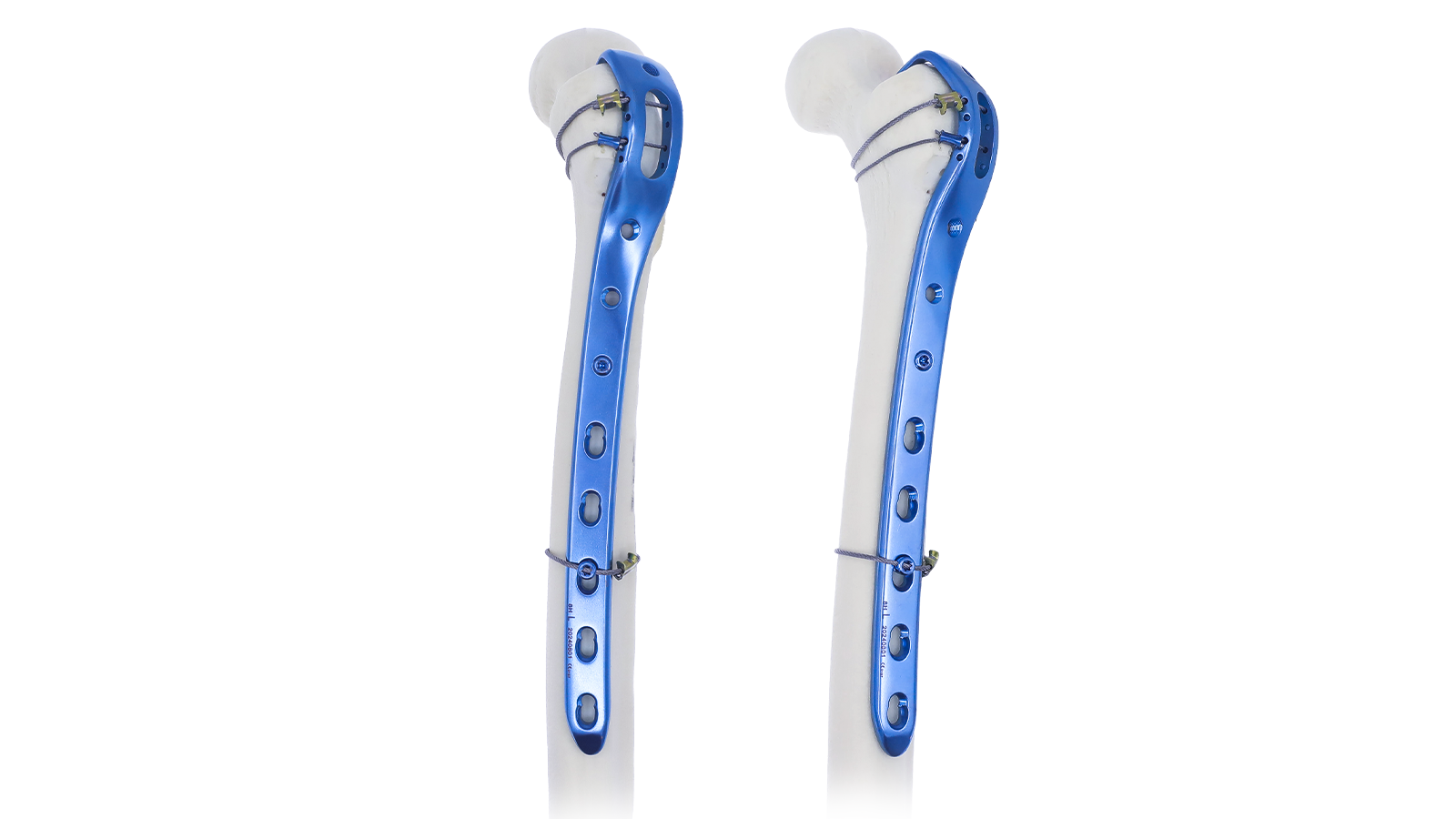 Lower Extremity locking plate system