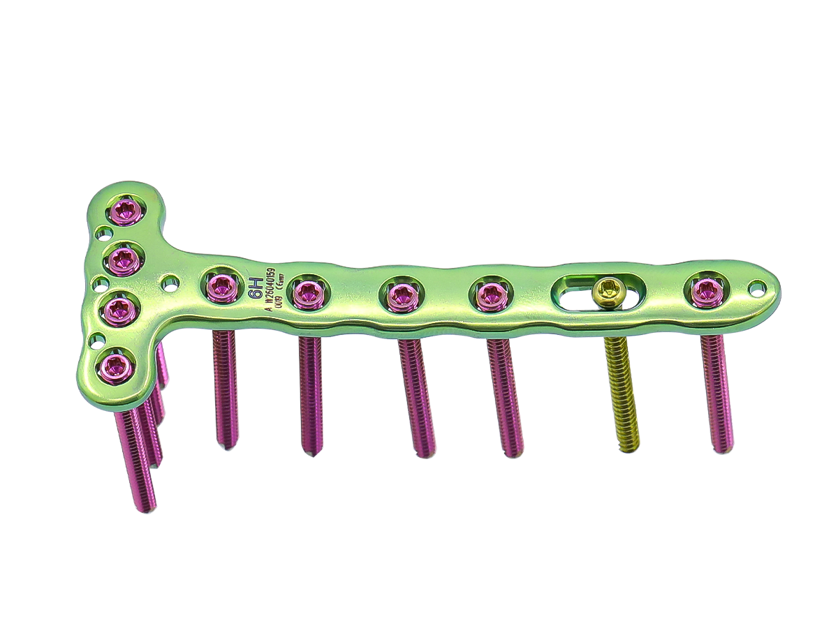 VA Distal Anterior Tibia Locking Plate CZMEDITECH