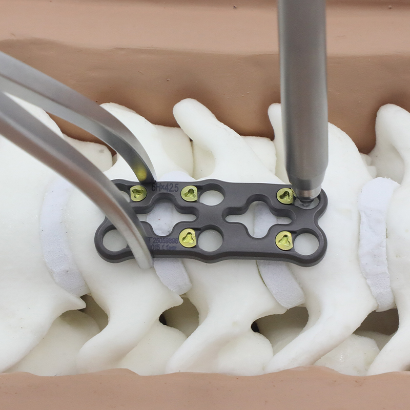 V&AElig;DDER Anterior cervikal plade-III
