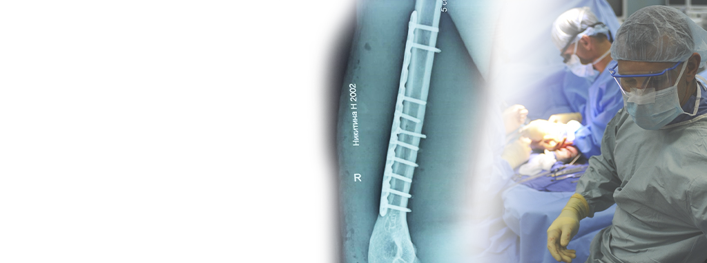Right humeral shaft fracture treated with a humeral locking plate