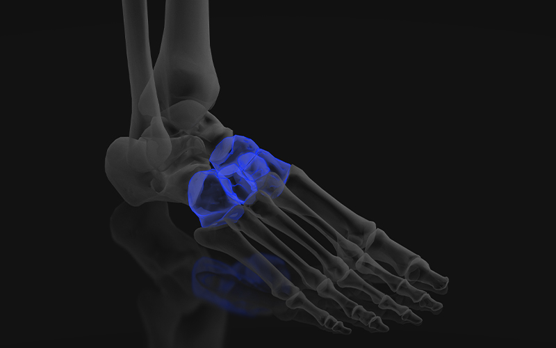 Midfoot bones highlighted in blue on a foot anatomy illustration